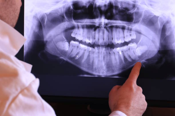 Best Broken or Cracked Tooth Emergency Dentist in Penn Estates, PA